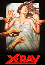 X-Ray (1981)