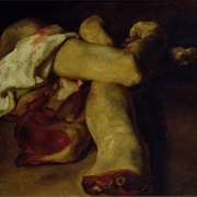 Anatomical Pieces (Théodore Géricault)