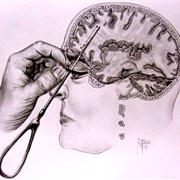Lobotomy