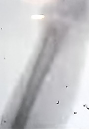 X-Ray Cinematography of Frog's Legs (1896)