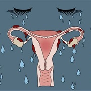 Premenstrual Dysphoric Disorder