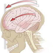 Suffered a Concussion