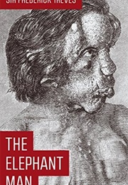 The Elephant Man and Other Reminiscences (Frederick Treves)