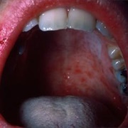 Contagious Innumeracy