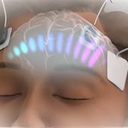 How Electroconvulsive Therapy Works