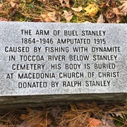 The Arm of Buel Stanley