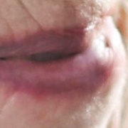 Respite Care in Charleston