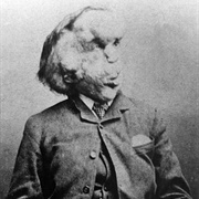 Joseph Merrick - The Elephant Man