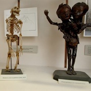 Warren Anatomical Museum