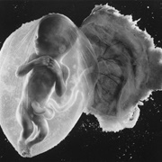 New View of Life, Fetus 18-Weeks (1965)