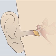 Earwax: Live With It