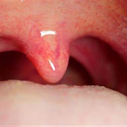 Uvula