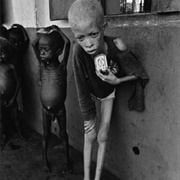 Albino Boy, Biafra (1969)