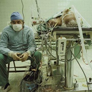 The First Heart Transplant in Poland (1987)