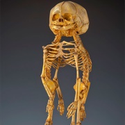 Mutter Museum (Philadelphia)