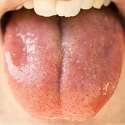 Sensitive Taste Buds