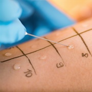 Allergy Testing
