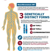 Neurofibromatosis