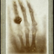 The Hand of Mrs. Wilhelm Röntgen (1895)