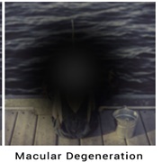 Losing Your Eyesight