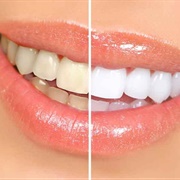 Get Your Teeth Whitened
