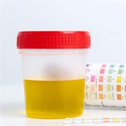 Urine