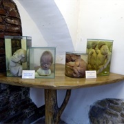 Museum of Malformations of the Human Body