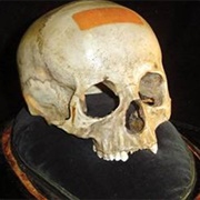 Mozart's Skull