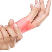 Carpal Tunnel Syndrome