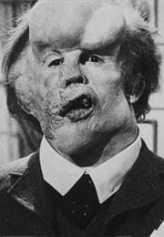 The Elephant Man (1980)
