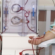 Kidney Dialysis Machine