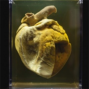 Phar Lap's Heart