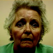 Progressive Supranuclear Palsy