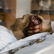 Musée De La Médecine