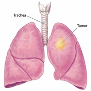 Lung