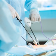 Laparoscopy