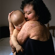 Phan Thị Kim Phúc With Baby (Joe McNally)