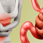 Can Cause Digestive Problems