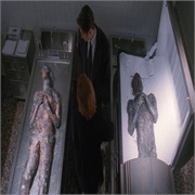 The X-Files: "Leonard Betts" (S4,E12)