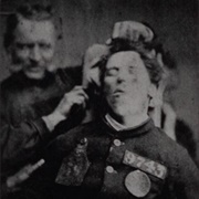 A Patient Restrained for the Purposes of Photography (James Crichton-Browne)