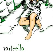 Varicella