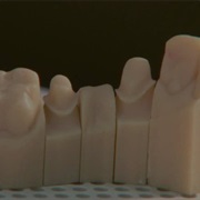 S16.E9: Digital Dentistry/Nail Clippers/Poster Restoration/Canola Oil