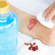 Clean Wounds