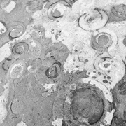 Ammonite Pavement, Lyme Regis