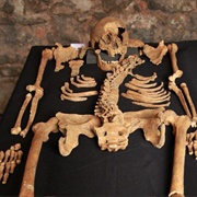 The Charterhouse Black Death Skeleton