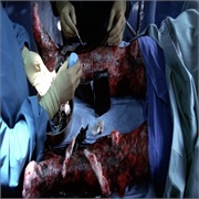 Nip/Tuck: "Reefer" (S4,E13)