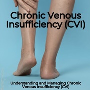 CVI (Chronic Venous Insufficiency)