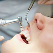 Dental Cleaning