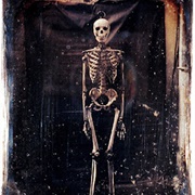 Skeleton of a Negro (Henri Jacquart and Émile Deramond)