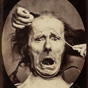 Plate 64 From Mécanisme De La Physionomie Humaine (Guillaume-Benjamin-Amand Duchenne De Boulogne)